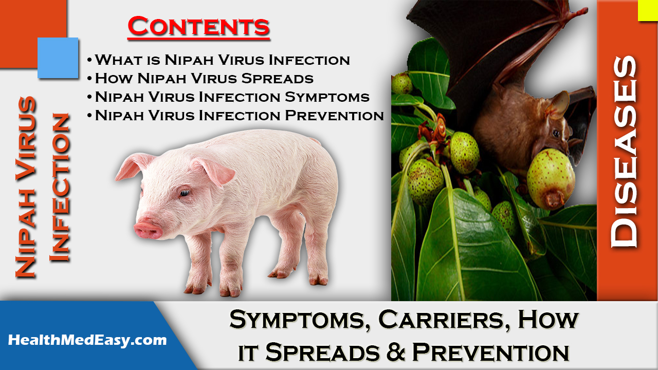 Nipah Virus Symptoms How It Spreads Prevention HealthMedEasy